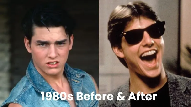 Tom Cruise teeth 1980s