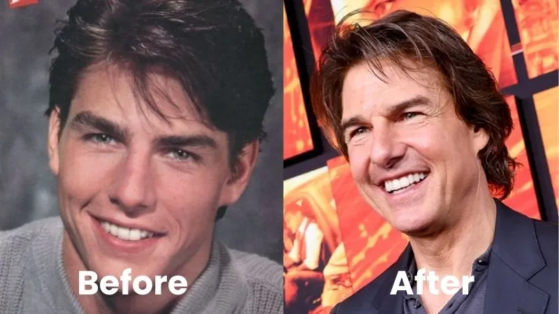 Tom Cruise Teeth